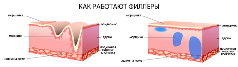 пластика лица